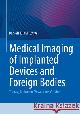 Medical Imaging of Implanted Devices and Foreign Bodies: Thorax, Abdomen, Vessels and Children Daniela Kildal 9783662707548 Springer-Verlag Berlin and Heidelberg GmbH &  - książka