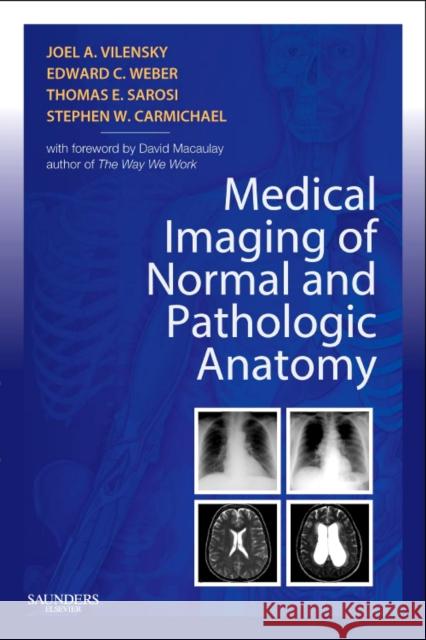 Medical Imaging of Normal and Pathologic Anatomy Joel A Vilensky 9781437706345  - książka