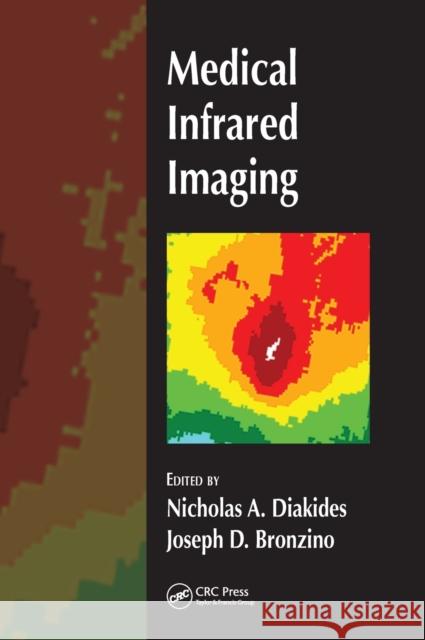 Medical Infrared Imaging Nicholas A. Diakides Joseph D. Bronzino 9780849390272 CRC Press - książka