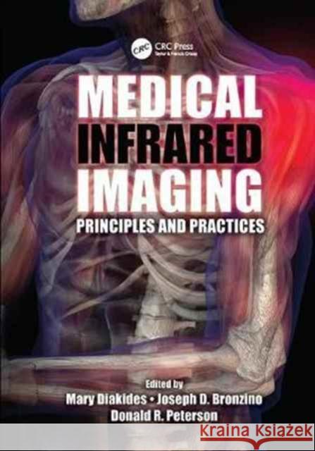 Medical Infrared Imaging: Principles and Practices  9781138072299  - książka