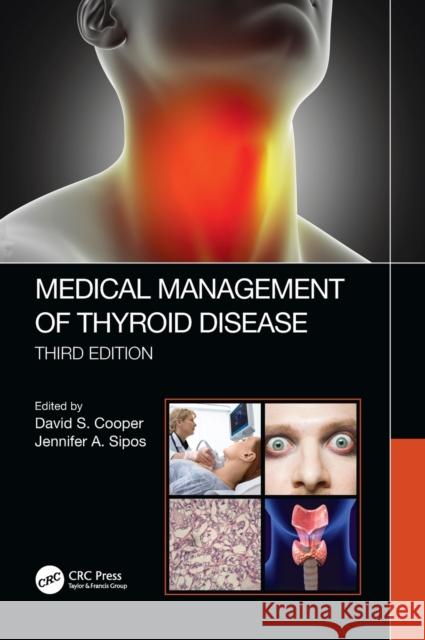 Medical Management of Thyroid Disease, Third Edition David S. Cooper Jennifer Sipos 9781138577237 CRC Press - książka