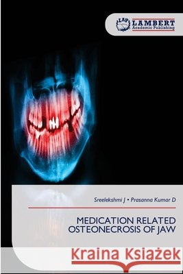 Medication Related Osteonecrosis of Jaw J, Sreelekshmi, D, Prasanna Kumar 9786209780523 LAP Lambert Academic Publishing - książka