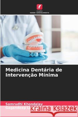 Medicina Dentária de Intervenção Mínima Khondalay, Samrudhi, Lamba, Gagandeep 9786208808617 Edições Nosso Conhecimento - książka