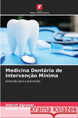 Medicina Dentária de Intervenção Mínima Agrawal, Adarsh, Trivedi, Ashish 9786209025341 Edições Nosso Conhecimento - książka