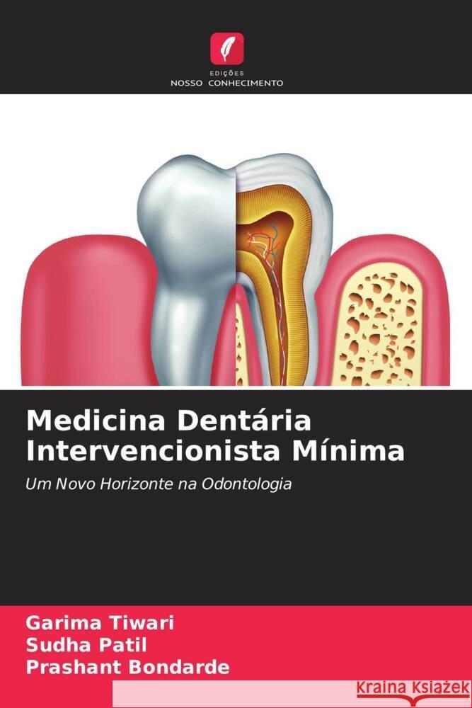 Medicina Dentária Intervencionista Mínima Tiwari, Garima, Patil, Sudha, Bondarde, Prashant 9786205060292 Edições Nosso Conhecimento - książka