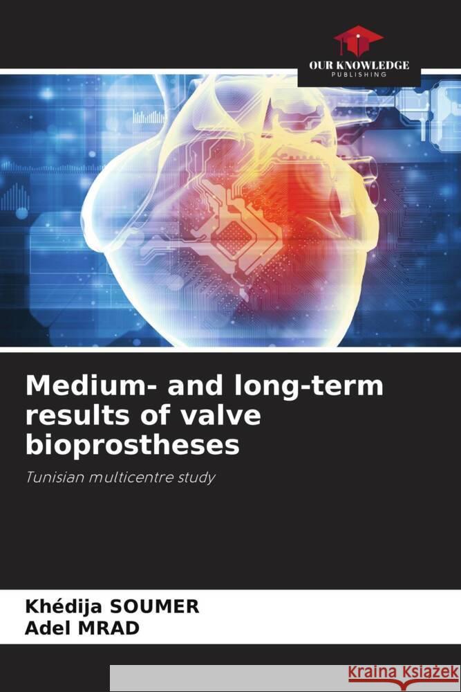 Medium- and long-term results of valve bioprostheses SOUMER, Khédija, MRAD, Adel 9786208198008 Our Knowledge Publishing - książka