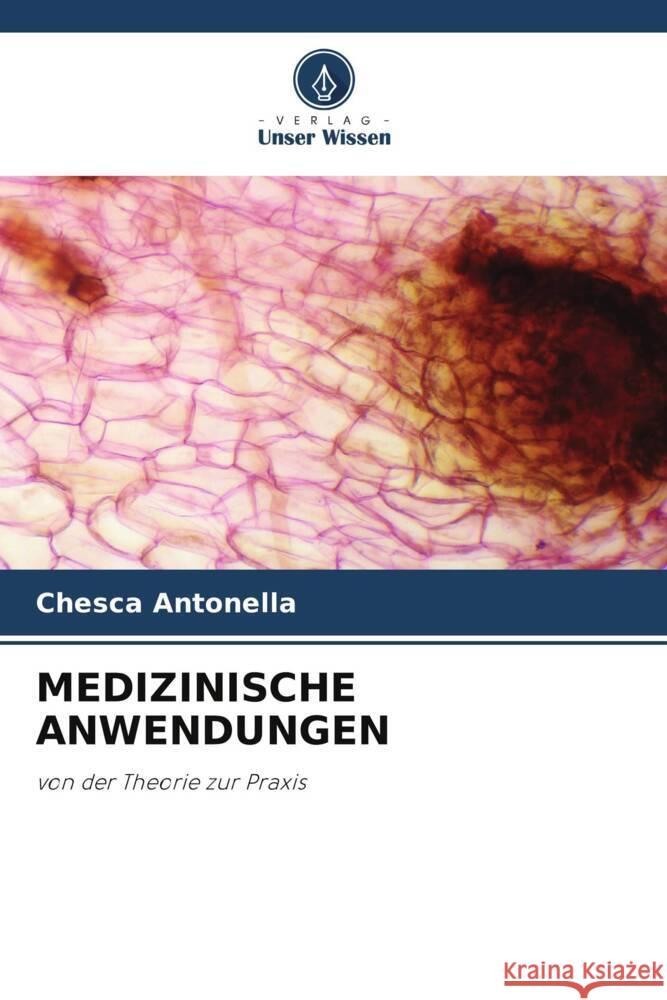 MEDIZINISCHE ANWENDUNGEN Antonella, Chesca 9786204790565 Verlag Unser Wissen - książka