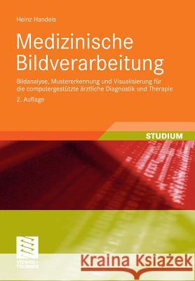 Medizinische Bildverarbeitung: Bildanalyse, Mustererkennung Und Visualisierung Für Die Computergestützte Ärztliche Diagnostik Und Therapie Handels, Heinz 9783835100770 Vieweg+Teubner - książka