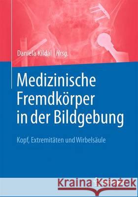 Medizinische Fremdkörper in Der Bildgebung: Kopf, Extremitäten Und Wirbelsäule Kildal, Daniela 9783662537497 Springer - książka