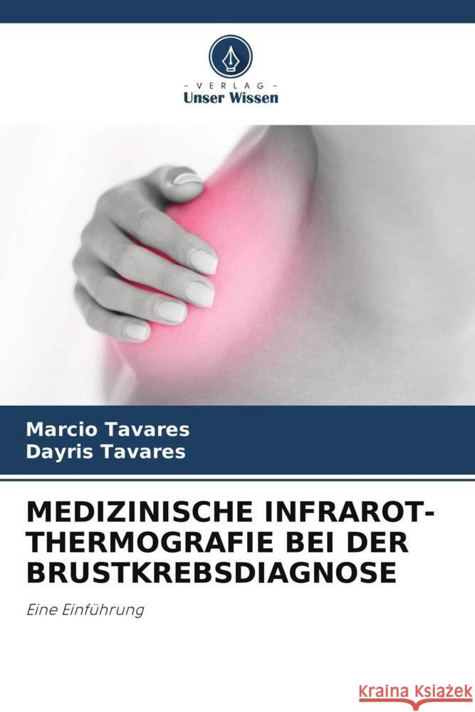 MEDIZINISCHE INFRAROT-THERMOGRAFIE BEI DER BRUSTKREBSDIAGNOSE Tavares, Marcio, Tavares, Dayris 9786205413890 Verlag Unser Wissen - książka