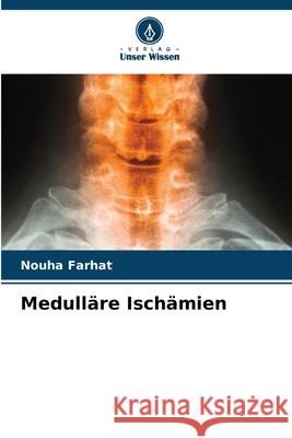 Medull?re Isch?mien Nouha Farhat 9786207904327 Verlag Unser Wissen - książka
