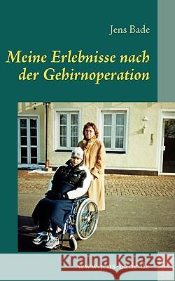 Meine Erlebnisse nach der Gehirnoperation Jens Bade 9783837009729 Books on Demand - książka