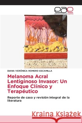 Melanoma Acral Lentiginoso Invasor: Un Enfoque Clínico y Terapéutico Romero Escamilla, Diana Verónica 9786209905223 Editorial Academica Espanola - książka