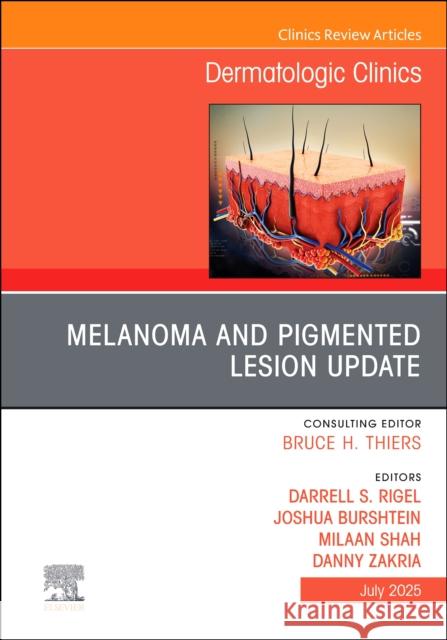 Melanoma and Pigmented Lesion Update, an Issue of Dermatologic Clinics: Volume 43-3 Darrell S. Rigel Joshua Burshtein Milaan Shah 9780443346934 Elsevier - książka