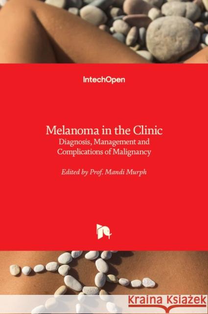 Melanoma in the Clinic: Diagnosis, Management and Complications of Malignancy Mandi Murph 9789533075716 Intechopen - książka