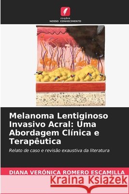 Melanoma Lentiginoso Invasivo Acral: Uma Abordagem Clínica e Terapêutica Romero Escamilla, Diana Verónica 9786630136081 Edicoes Nosso Conhecimento - książka