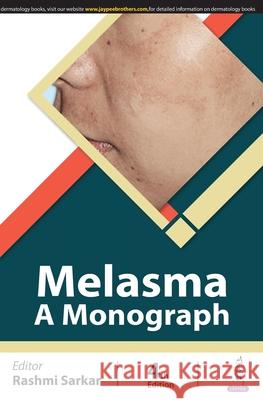 Melasma: A Monograph Rashmi Sarkar 9789356968752 Jaypee Brothers Medical Publishers - książka