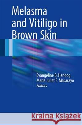 Melasma and Vitiligo in Brown Skin Evangeline B. Handog Maria Juliet Enriquez-Macarayo 9788132236627 Springer - książka