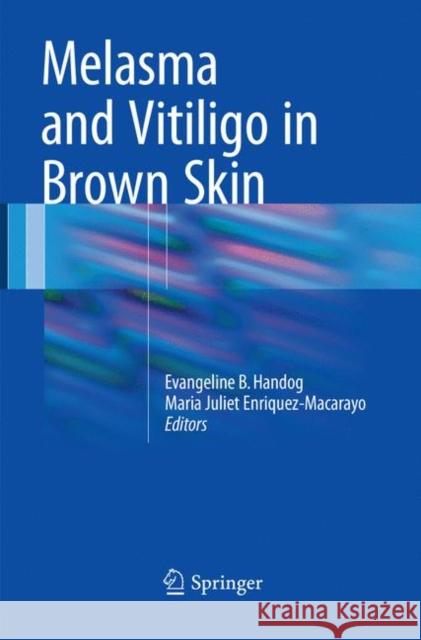 Melasma and Vitiligo in Brown Skin  9788132238812 Springer - książka