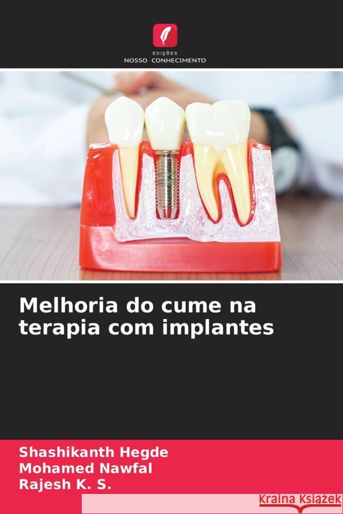 Melhoria do cume na terapia com implantes Hegde, Shashikanth, NAWFAL, MOHAMED, K. S., Rajesh 9786208292935 Edições Nosso Conhecimento - książka