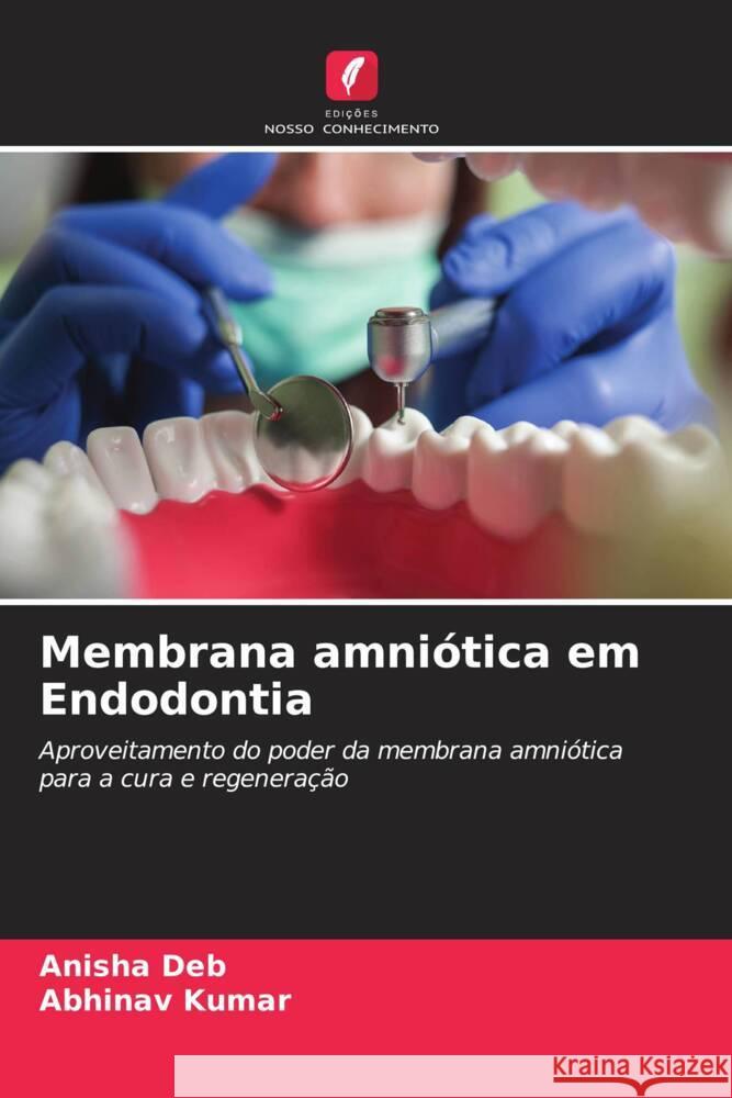 Membrana amni?tica em Endodontia Anisha Deb Abhinav Kumar 9786208139810 Edicoes Nosso Conhecimento - książka