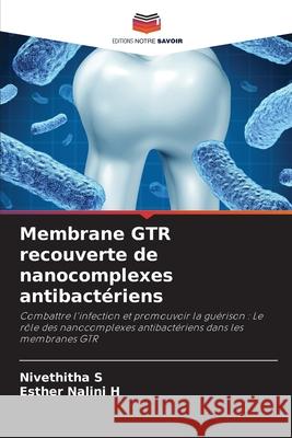 Membrane GTR recouverte de nanocomplexes antibactériens S, Nivethitha, H, Esther Nalini 9786209455582 Editions Notre Savoir - książka