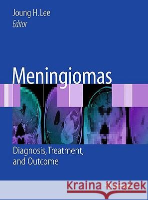 Meningiomas: Diagnosis, Treatment, and Outcome Lee, Joung H. 9781848829107 Springer - książka