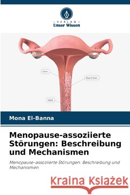 Menopause-assoziierte Störungen: Beschreibung und Mechanismen El-Banna, Mona 9786208801991 Verlag Unser Wissen - książka