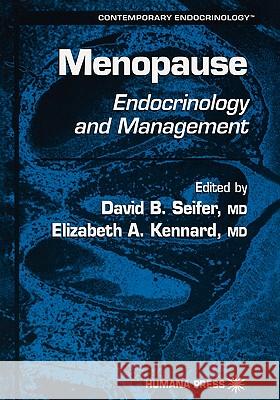 Menopause: Endocrinology and Management Seifer, David B. 9781617371295 Springer - książka