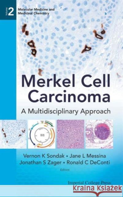 Merkel Cell Carcinoma: A Multidisciplinary Approach Vernon K. Sondak Jane L. Messina Jonathan S. Zager 9781848163126 Imperial College Press - książka