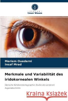 Merkmale und Variabilität des iridokornealen Winkels Meriem Ouederni, Insaf Mrad 9786204044361 Verlag Unser Wissen - książka