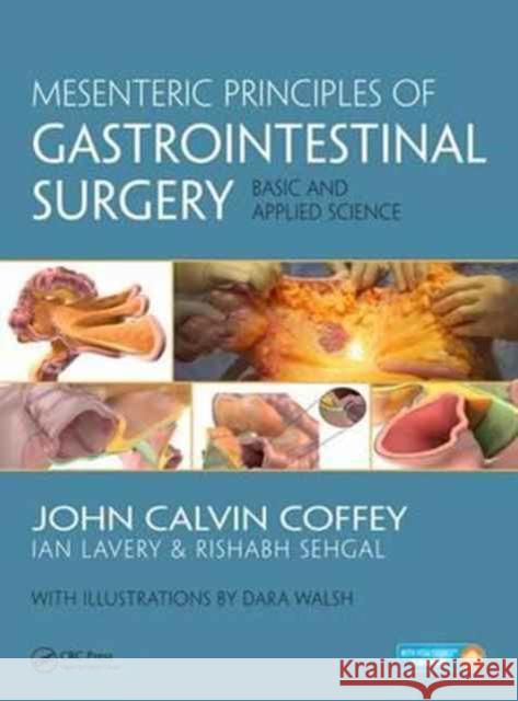 Mesenteric Principles of Gastrointestinal Surgery: Basic and Applied Science John Calvin Coffey Rishabh Sehgal Dara Walsh 9781498711227 CRC Press - książka