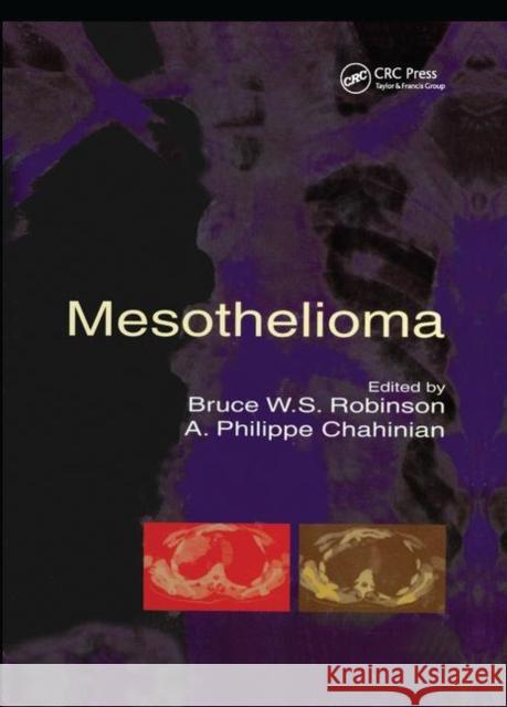 Mesothelioma Bruce W. S. Robinson A. Philippe Chahinian 9780367396374 CRC Press - książka