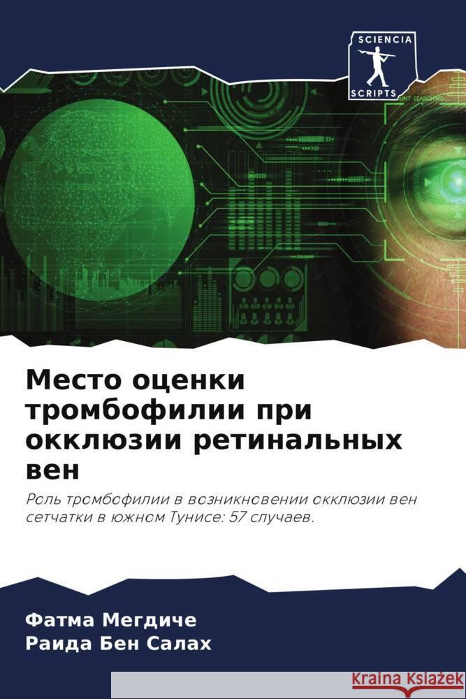 Mesto ocenki trombofilii pri okklüzii retinal'nyh wen Megdiche, Fatma, Ben Salah, Raida 9786204565002 Sciencia Scripts - książka