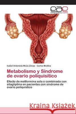 Metabolismo y Síndrome de ovario poliquisitico Meza Zerpa, Isabel Antonieta 9786202125949 Editorial Académica Española - książka