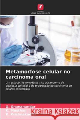 Metamorfose celular no carcinoma oral Gnananandar, G., Masthan, K., Krishnakumar, R. 9786208908805 Edições Nosso Conhecimento - książka