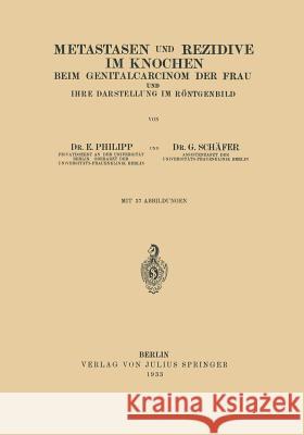 Metastasen Und Rezidive Im Knochen: Beim Genitalcarcinom Der Frau Und Ihre Darstellung Im Röntgenbild Philipp, E. 9783642983283 Springer - książka