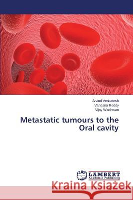Metastatic tumours to the Oral cavity Venkatesh Arvind                         Reddy Vandana                            Wadhwan Vijay 9783659524400 LAP Lambert Academic Publishing - książka