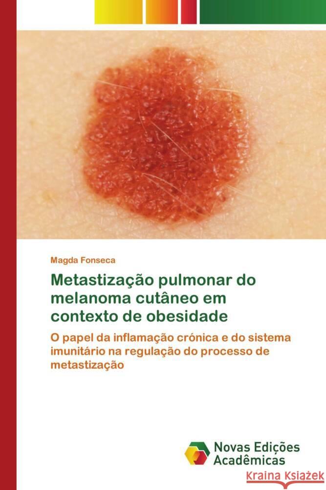 Metastização pulmonar do melanoma cutâneo em contexto de obesidade Fonseca, Magda 9786206757467 Novas Edições Acadêmicas - książka