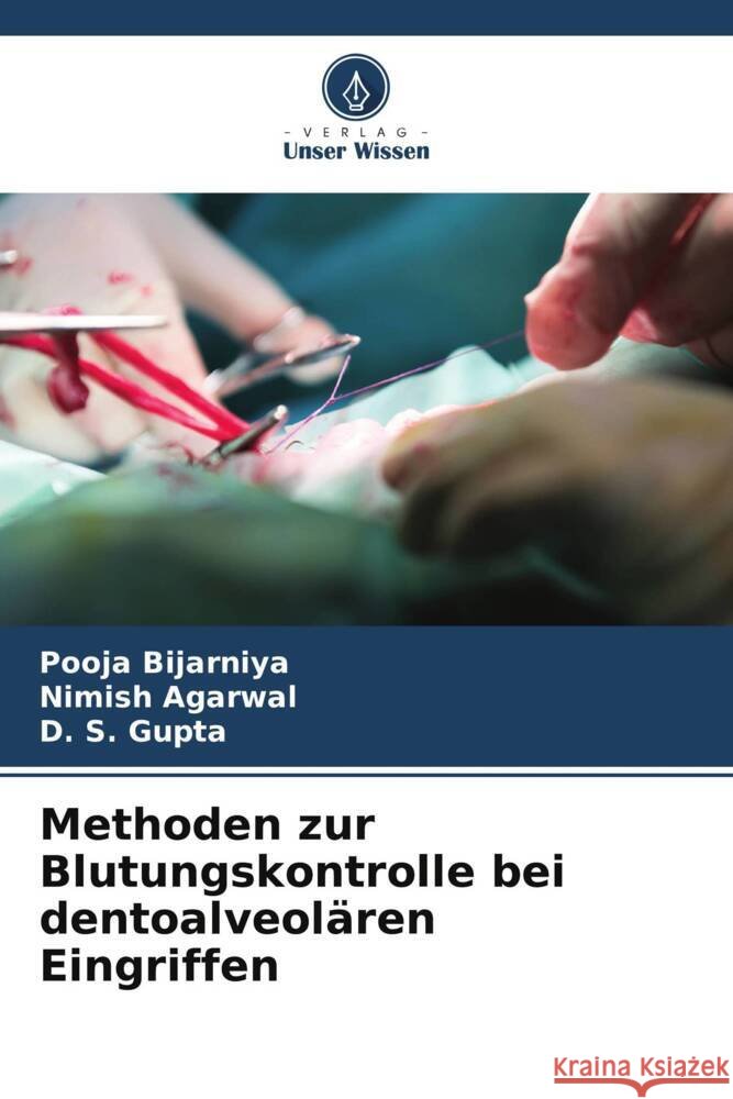 Methoden zur Blutungskontrolle bei dentoalveol?ren Eingriffen Pooja Bijarniya Nimish Agarwal D. S. Gupta 9786207490196 Verlag Unser Wissen - książka