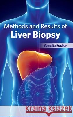 Methods and Results of Liver Biopsy Amelia Foster 9781632422774 Foster Academics - książka