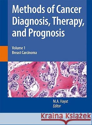 Methods of Cancer Diagnosis, Therapy and Prognosis: Breast Carcinoma Hayat, M. A. 9781402083686 Not Avail - książka