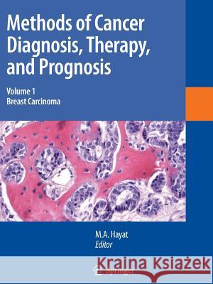 Methods of Cancer Diagnosis, Therapy and Prognosis: Breast Carcinoma M. A. Hayat 9789048178582 Springer - książka