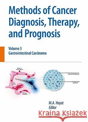 Methods of Cancer Diagnosis, Therapy and Prognosis: Gastrointestinal Cancer Hayat, M. A. 9781402088995 Springer - książka
