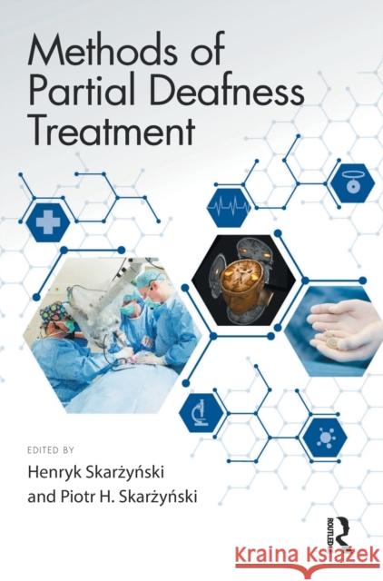 Methods of Partial Deafness Treatment Henryk Skarzynski Piotr H. Skarzynski 9780367759605 Routledge - książka