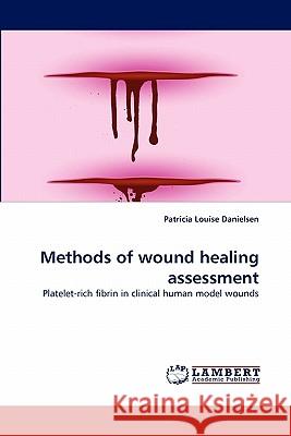 Methods of wound healing assessment Danielsen, Patricia Louise 9783843393775 LAP Lambert Academic Publishing AG & Co KG - książka