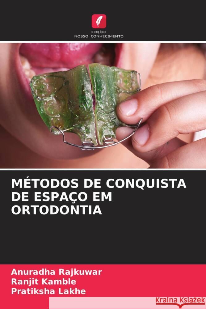 Metodos de Conquista de Espaco Em Ortodontia Anuradha Rajkuwar Ranjit Kamble Pratiksha Lakhe 9786206013846 Edicoes Nosso Conhecimento - książka