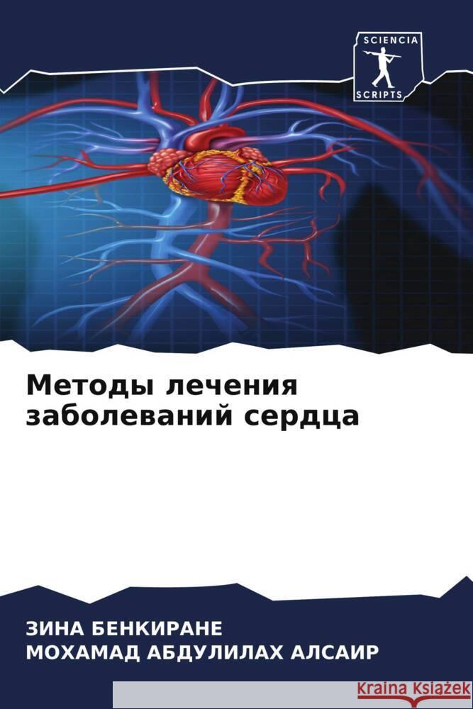 Metody lecheniq zabolewanij serdca BENKIRANE, ZINA, ABDULILAH ALSAIR, MOHAMAD 9786203329629 Sciencia Scripts - książka