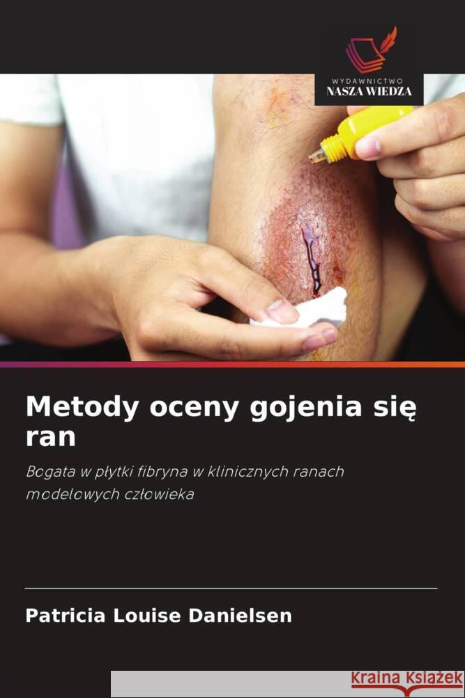 Metody oceny gojenia sie ran Danielsen, Patricia Louise 9786202744621 Wydawnictwo Nasza Wiedza - książka