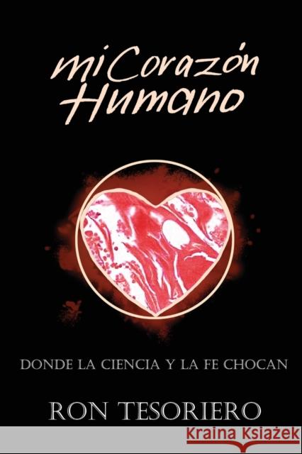 Mi Coraz Ron Tesoriero 9780645186338 Ron Tesoriero - książka